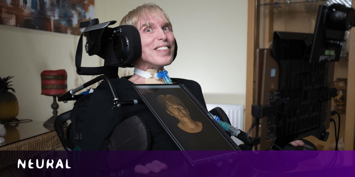 How Intel helped give the ‘world’s first’ cyborg a voice