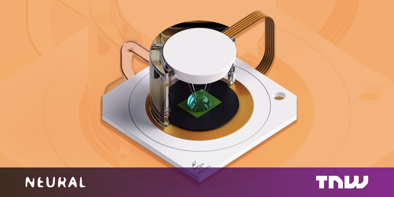 Importa de quem são as células cerebrais que usamos nos units do futuro? Importa de quem são as células cerebrais que usamos nos units do futuro?