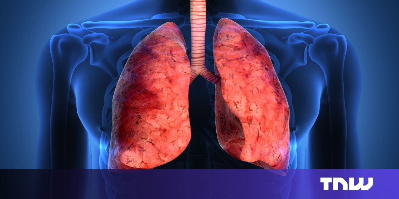 Bioprinted organs '10-15 years away,' says startup regenerating skin