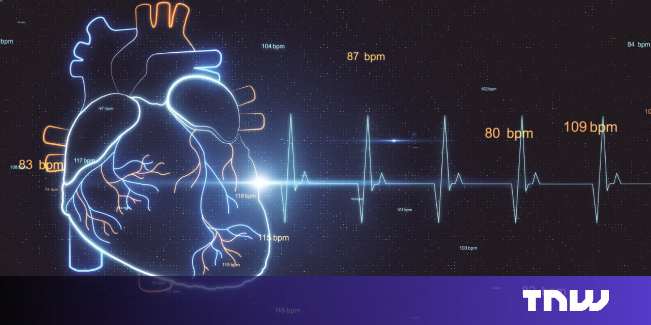 Cedars-Sinai's AI beats specialist models at reading heart scam