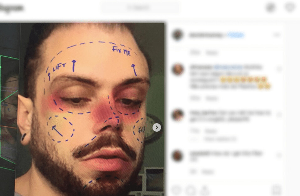 Instagram will remove filters promoting cosmetic surgery amid mental health concerns