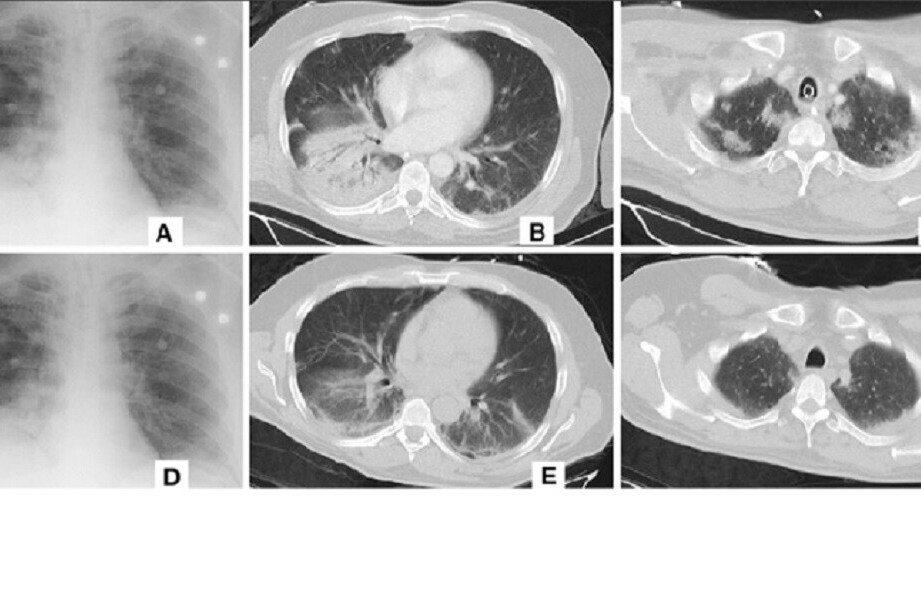 Alibaba’s new AI system can detect coronavirus in seconds with 96% accuracy
