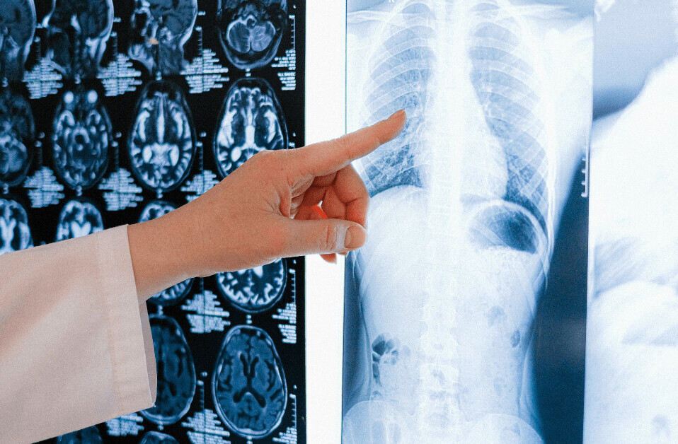 AI imaging database for COVID-19 diagnosis provided to UK hospitals
