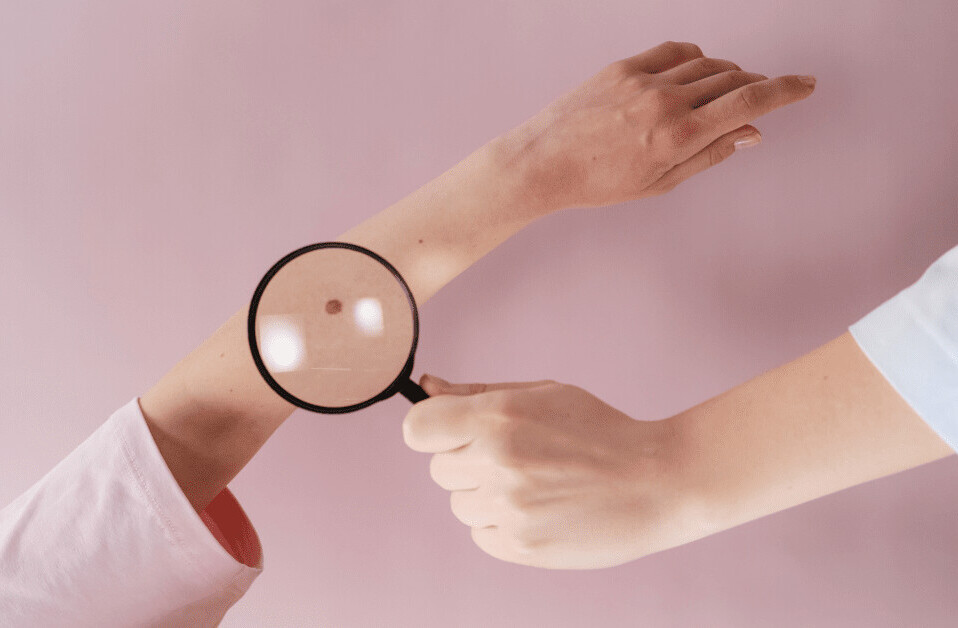 This ‘AI doctor’ can assess skin melanoma as accurately as human dermatologists