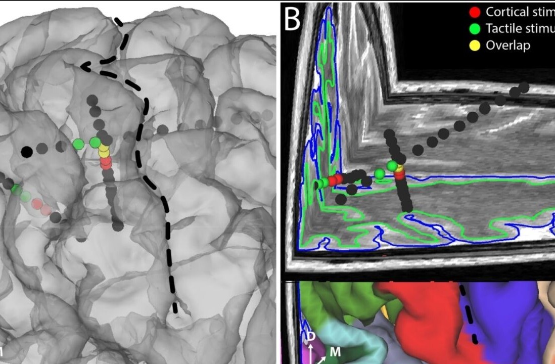 Eureka! Brain implant creates feelings in the fingertips