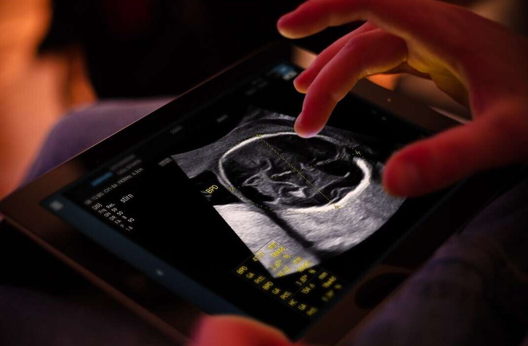 Samsung completes €86M takeover of French AI ultrasound startup Sonio