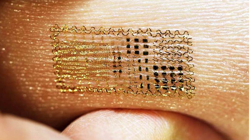 Major scientific breakthrough: Electronic skin tattoos that are so, so cool