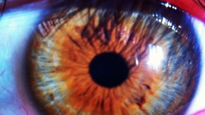 Why the iPhone should have a dedicated physical shutter button