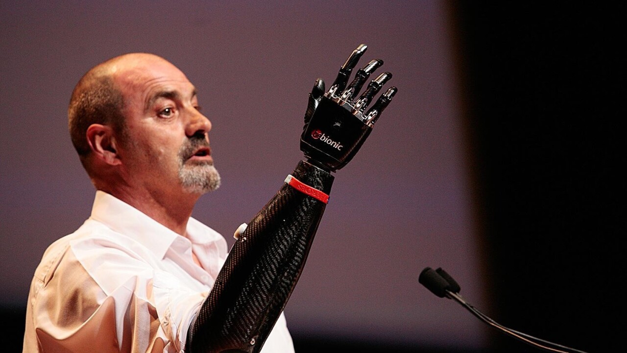 A bionic arm gives life back to a deserving man