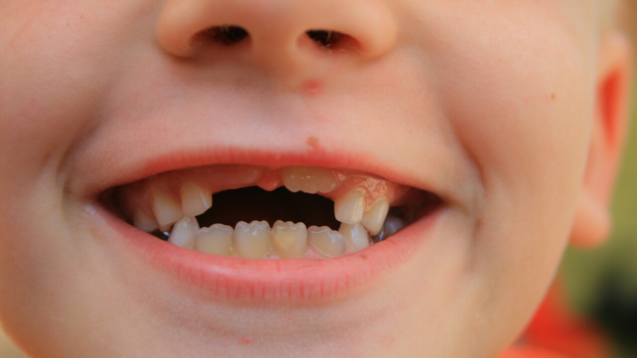 This guy built a machine to transport his kids’ teeth straight to the tooth fairy