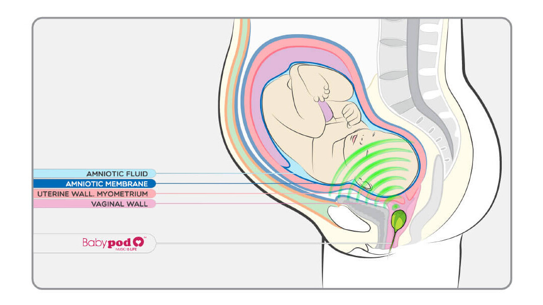 Babypod entertains your fetus with an insertable speaker for your baby maker