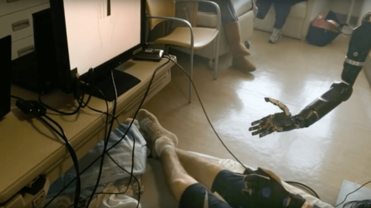This mind-controlled prosthetic arm can control individual finger movements