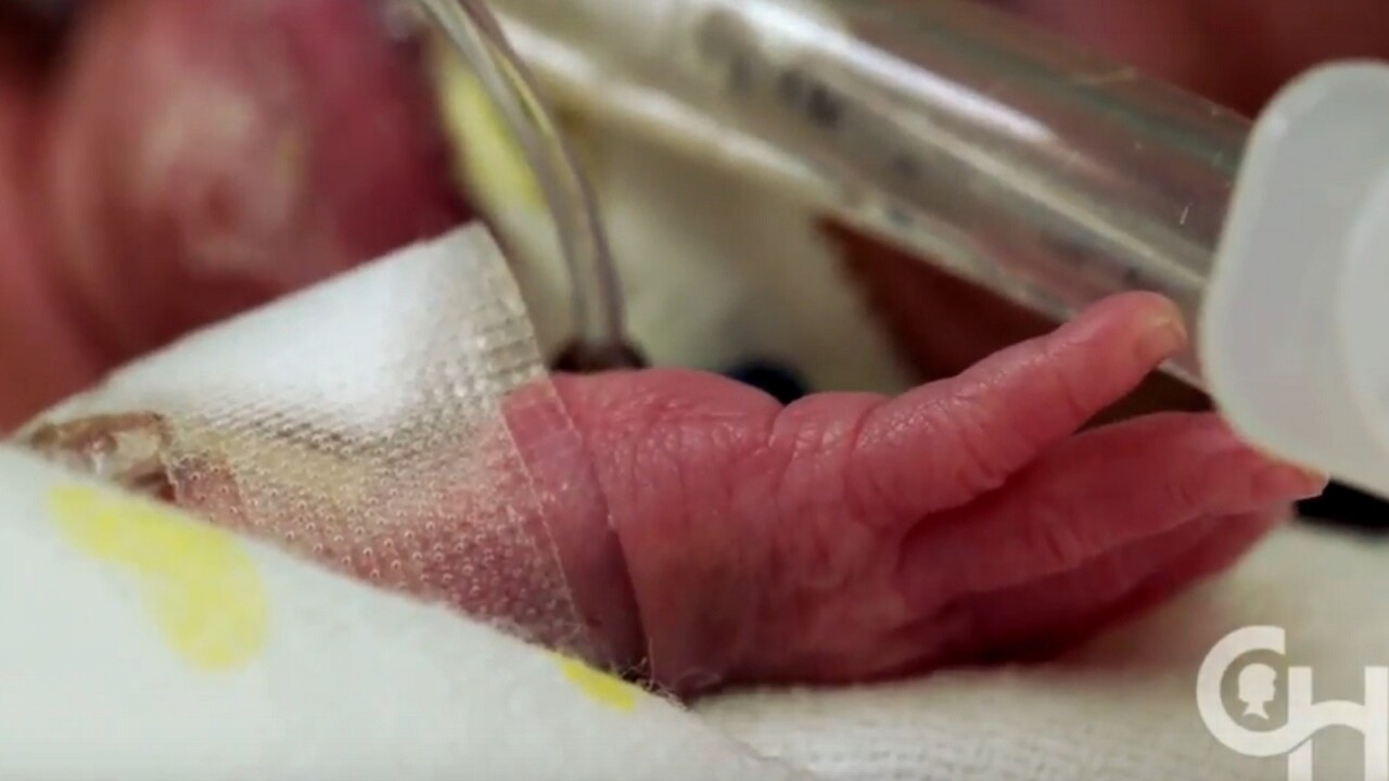 Researchers create artificial womb for premature babies