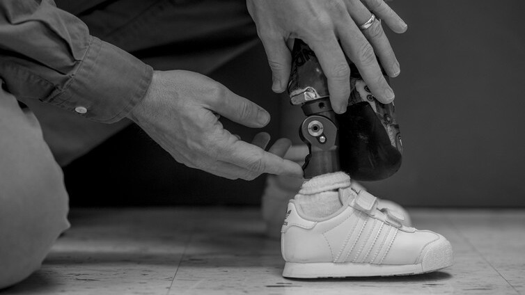 Military-funded prosthetic technologies benefit veterans, but also kids
