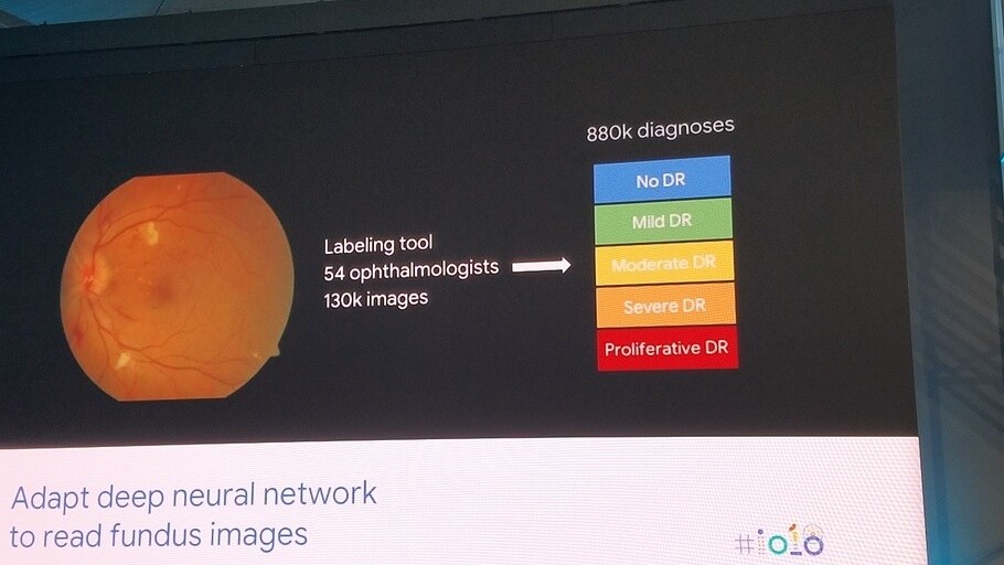 Seeing is believing: How AI could prevent blindness for 415 million people (right now)