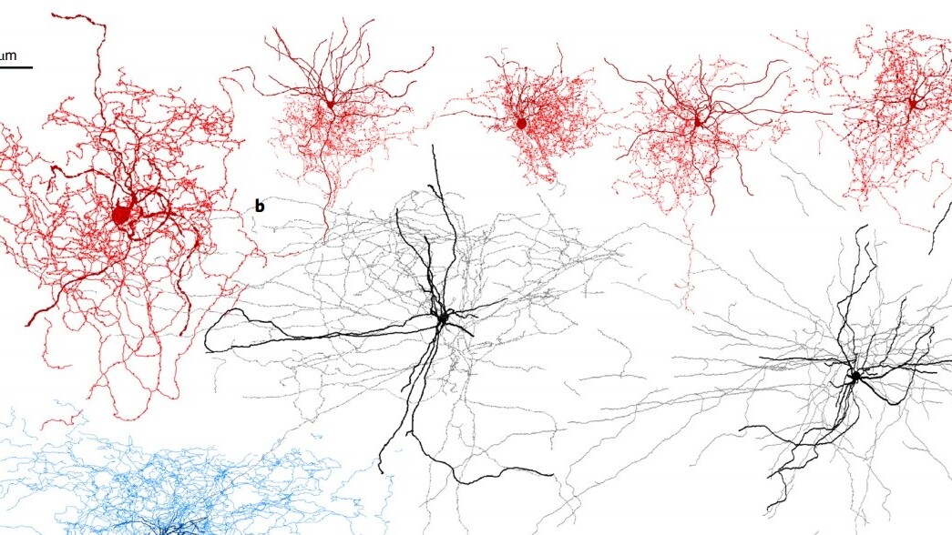 Brain cell discovery could help scientists understand consciousness