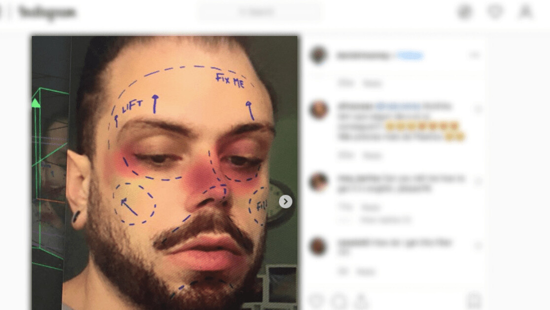 Instagram will remove filters promoting cosmetic surgery amid mental health concerns