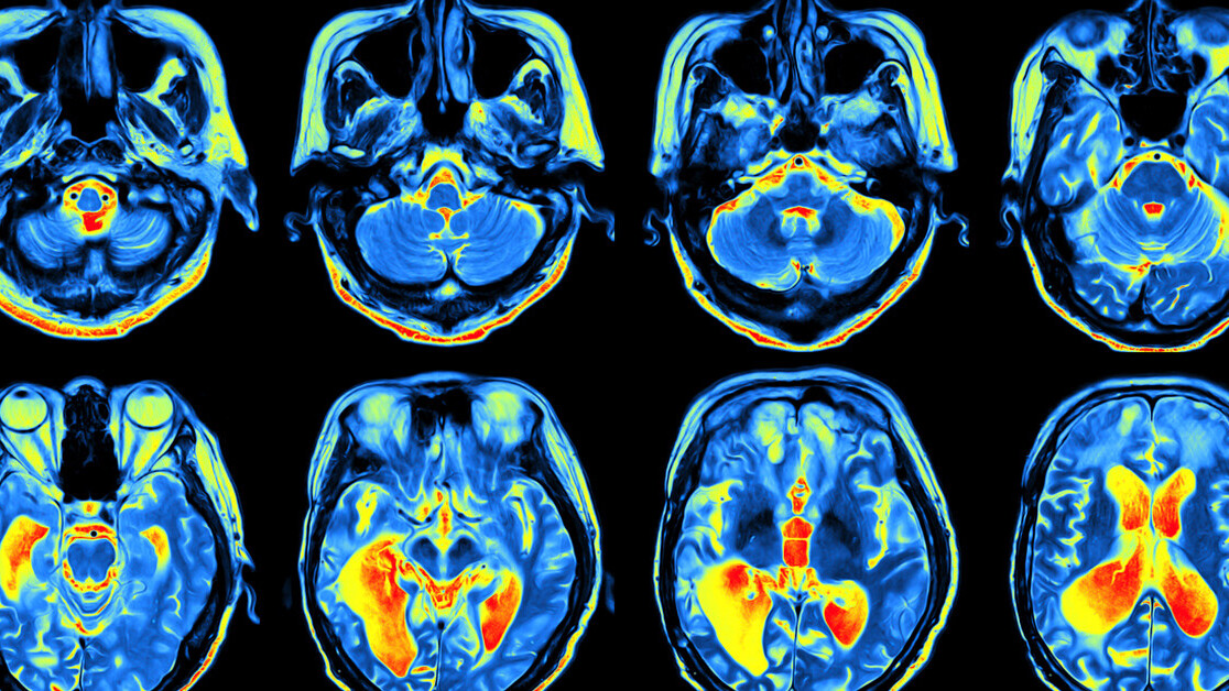 Science can’t explain consciousness — but panpsychism might crack the mystery