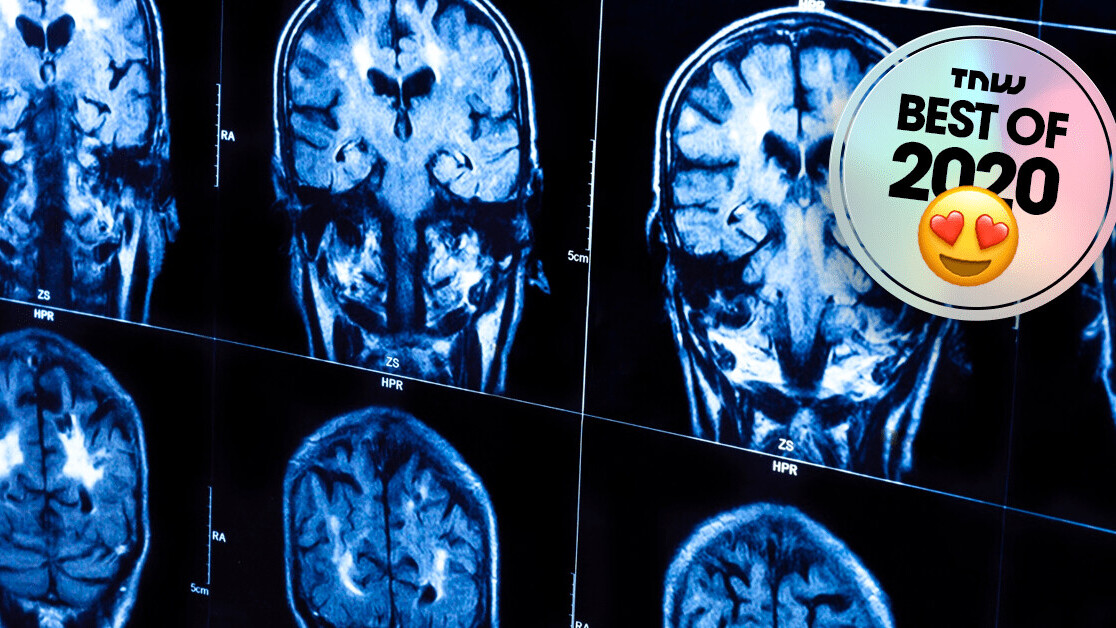 Scientists may have found the missing link between brain matter and consciousness