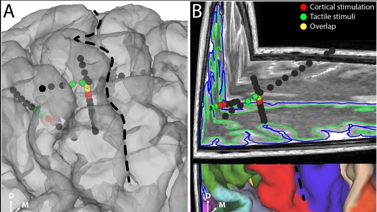 Eureka! Brain implant creates feelings in the fingertips