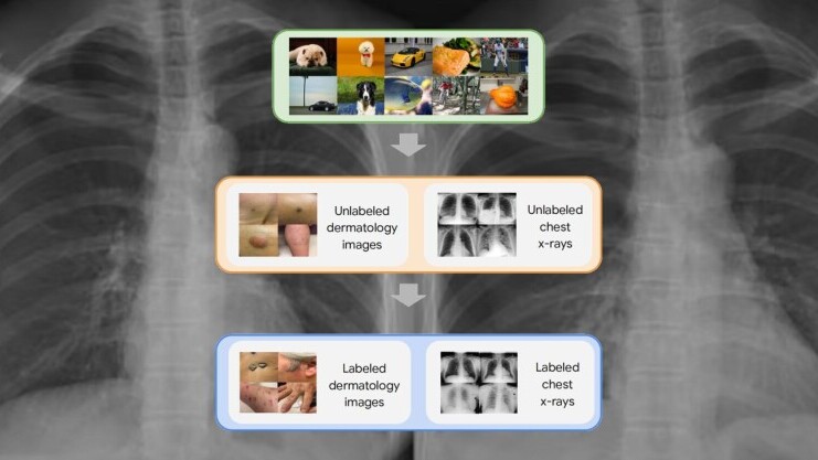 Google Research: Self-supervised learning is transforming medical imaging