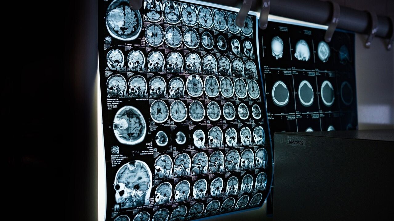 Eye-tracking VR system helps children stay still during MRI scans