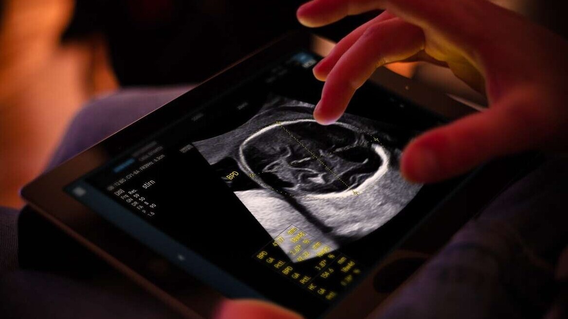 Samsung completes €86M takeover of French AI ultrasound startup Sonio