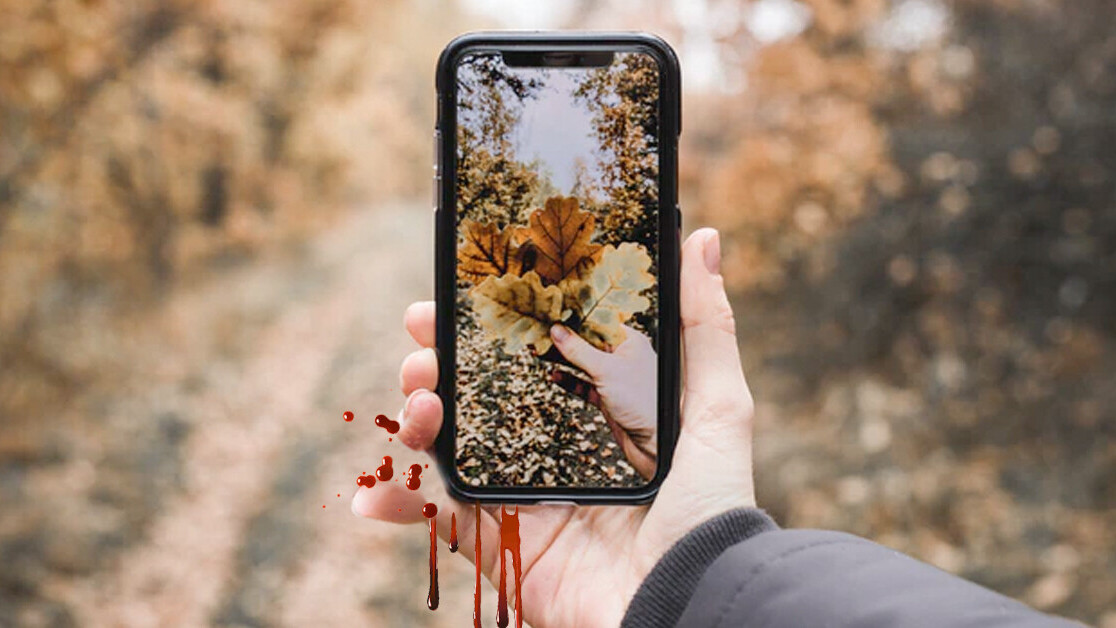 Smartphone pinky, text claw, and other injuries caused by excessive phone use