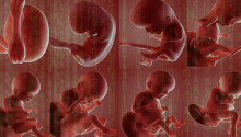 What AI analysis of placentas can teach us about childbirth and health Featured Image