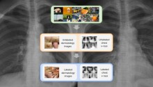 Google Research: Self-supervised learning is transforming medical imaging Featured Image