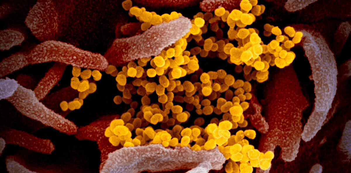 AI sent first coronavirus alert, but underestimated the danger