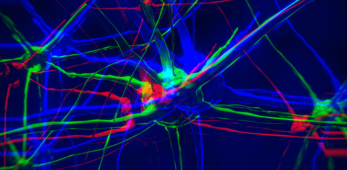 The case for neurodiversity: Why companies are hiring more autistic people