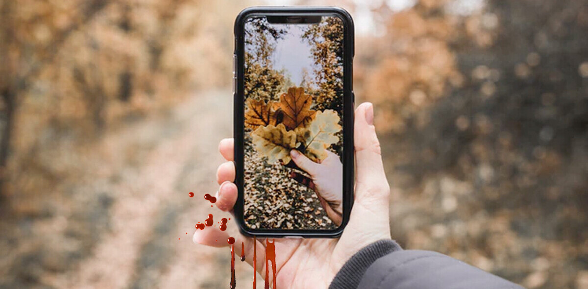 Smartphone pinky, text claw, and other injuries caused by excessive phone use