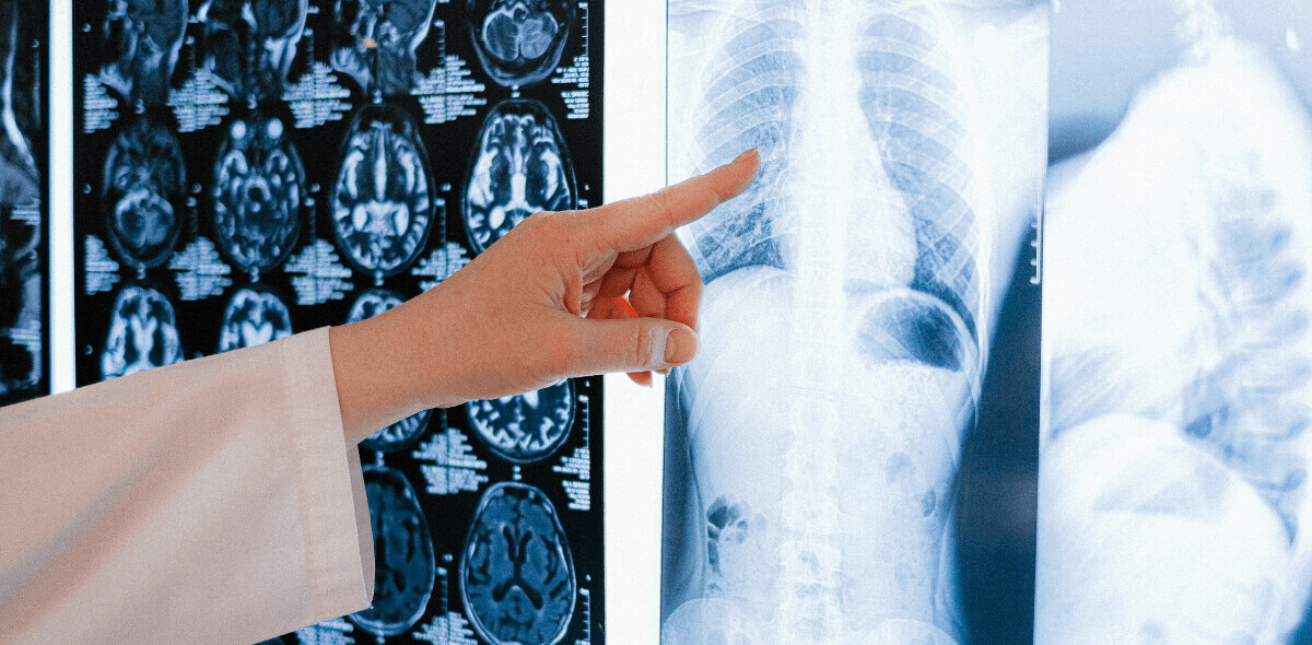AI imaging database for COVID-19 diagnosis provided to UK hospitals