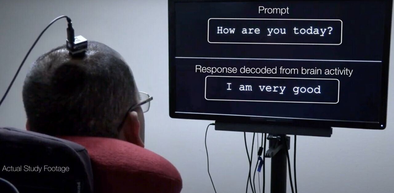 In scientific first, brain implant turns paralyzed man’s thoughts into ‘speech’