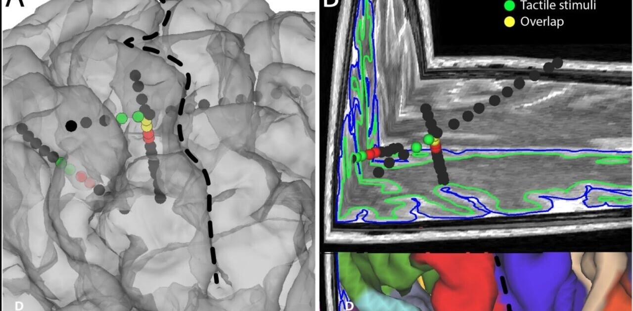 Eureka! Brain implant creates feelings in the fingertips