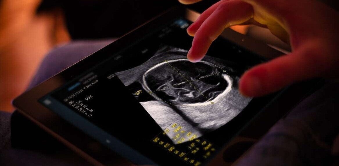 Samsung completes €86M takeover of French AI ultrasound startup Sonio