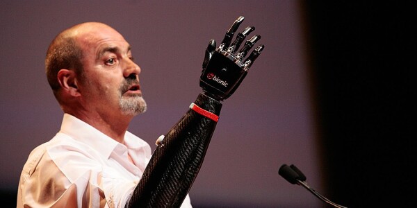 A bionic arm gives life back to a deserving man