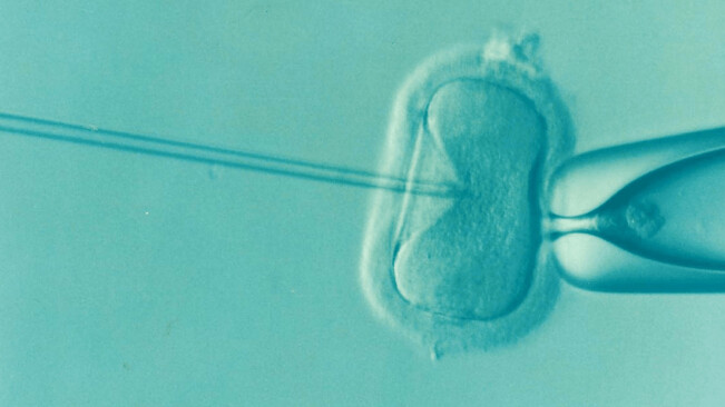 Controversial new test could be used to screen embryos for intelligence