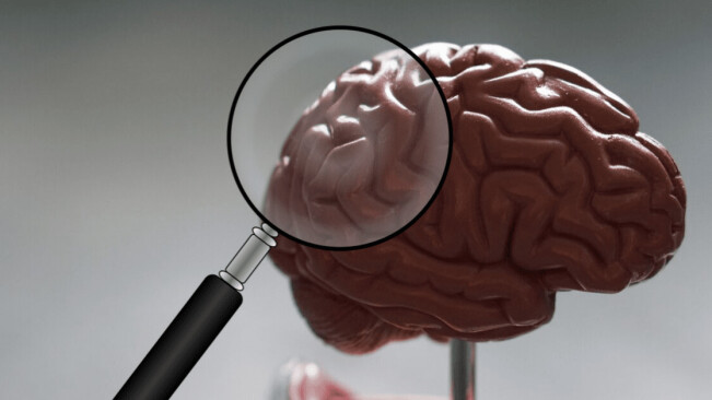 Studying brains can explain why tech affects men and women differently