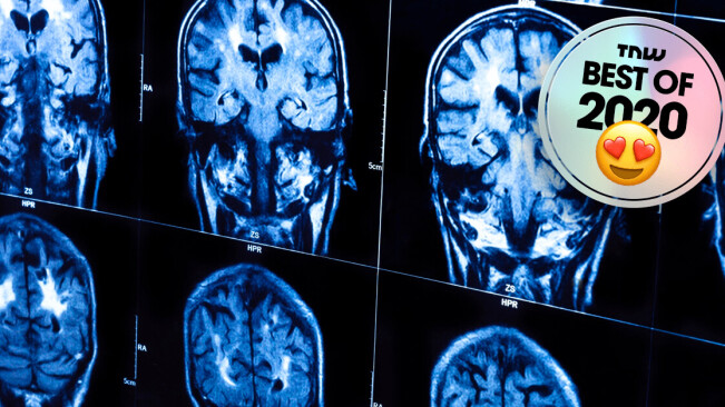 Scientists may have found the missing link between brain matter and consciousness