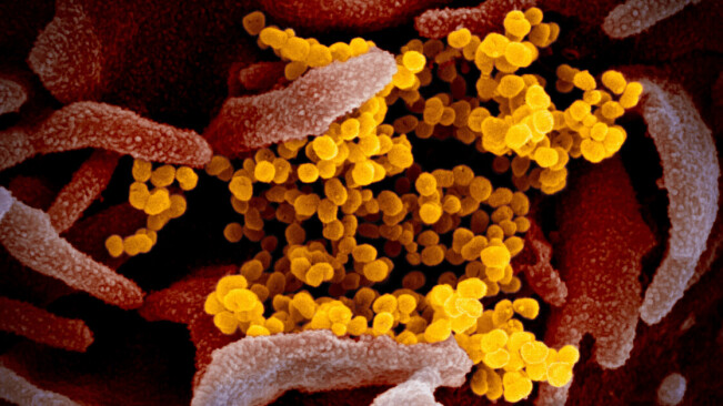 AI sent first coronavirus alert, but underestimated the danger