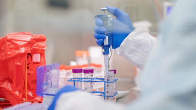 Spain plans to use robots to test 80,000 people a day for the coronavirus