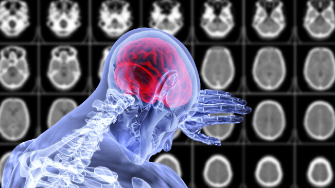 Over a third of coronavirus patients show neurological symptoms, study reports